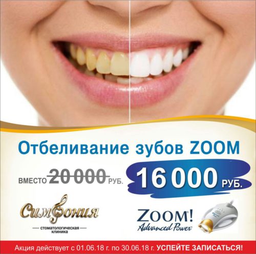 отбеливание zoom зубов казань