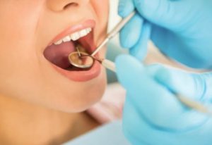 лечение кариеса в стоматологии